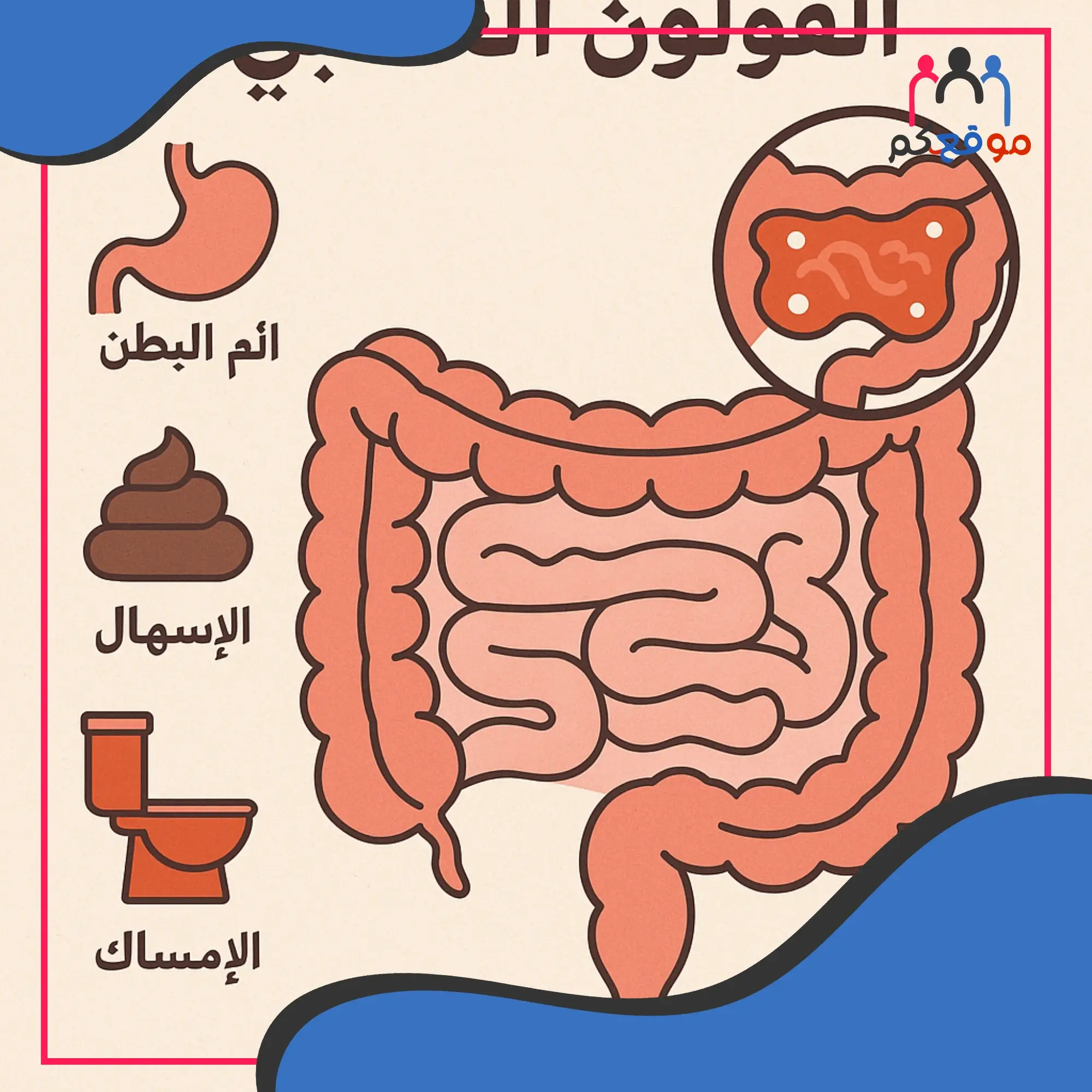 علاج القولون العصبي بالأعشاب