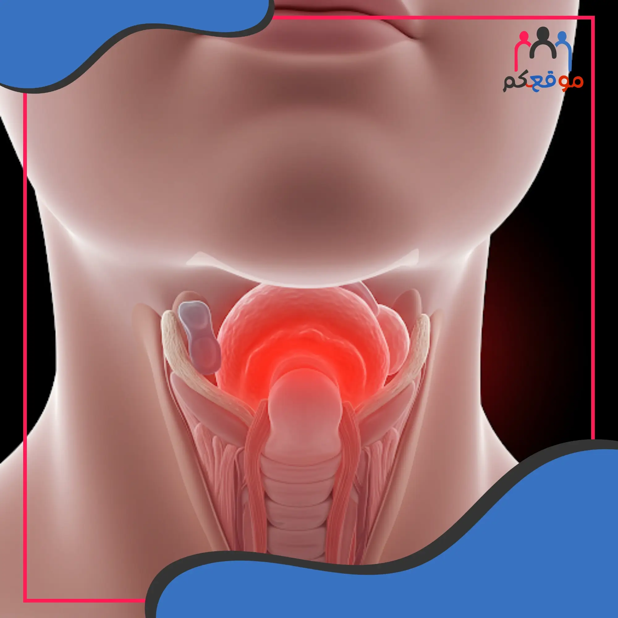 علاج التهاب الحلق